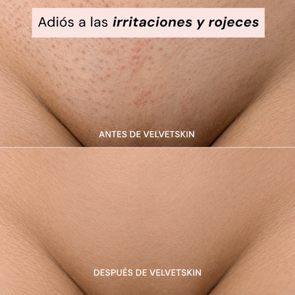 VelvetSkin 2 en 1 - Depiladora Íntima