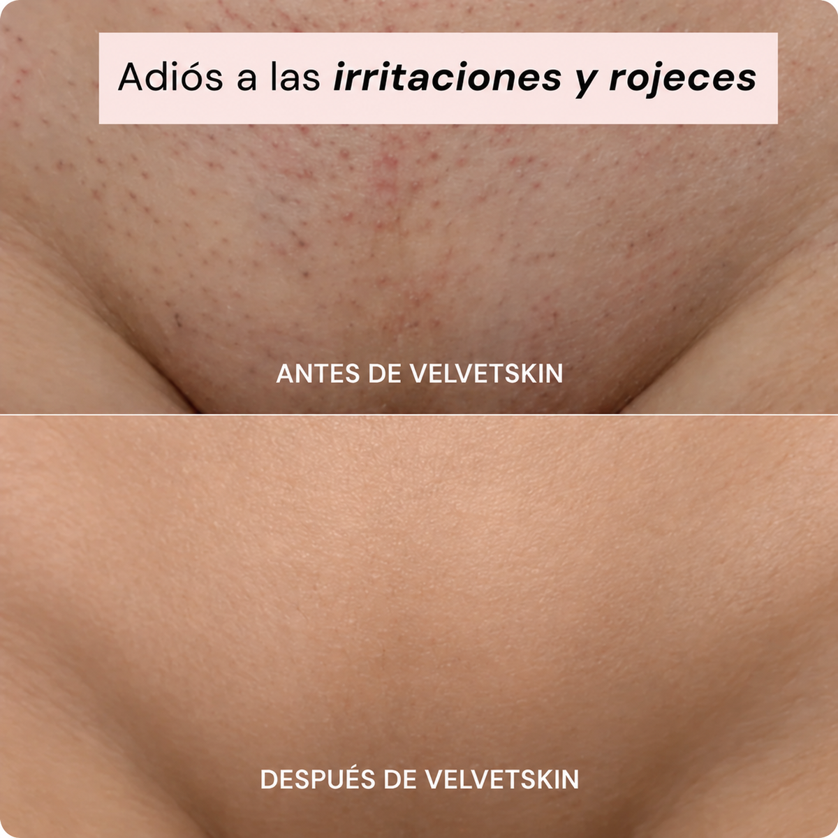 Depiladora Íntima 2 en 1 VelvetSkin