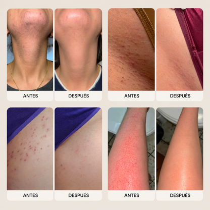 Depiladora Íntima 2 en 1 VelvetSkin